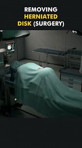 974K views · 4.2K reactions | Removing Herniated Disc Surgery 3D Animation | Ghost Medical Productions | Facebook