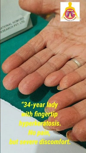 Fingertip Hyperkeratosis Explained | When Moisturisers Make Skin Worse .