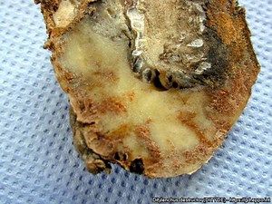 Nématode de la pomme de terre