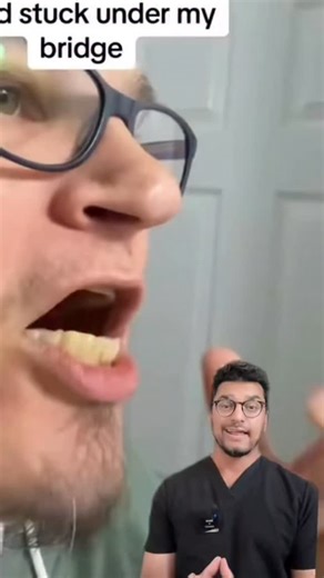 Why Do Implant Dentures Fail? 🦷⚠️ (And how to avoid it) Implant-supported dentures are life-changing — but they’re not failure-proof. Here’s why problems happen: 1️⃣ Poor Bone Quality or Bone Loss Implants need solid bone to stay stable. ➡️ Bone loss from gum disease, aging, or lack of planning = loose implants. 2️⃣ Bad Oral Hygiene Yes — implants can get infected too. 🦠 Peri-implantitis (implant gum disease) is a major cause of failure. 3️⃣ Poor Fit or Bite Issues If the denture doesn’t fit c