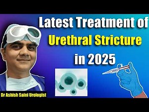Latest treatment of urethral stricture