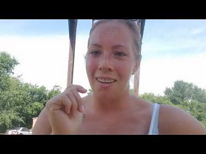 *Dentures at 30* Day 5!! I have sore spots!