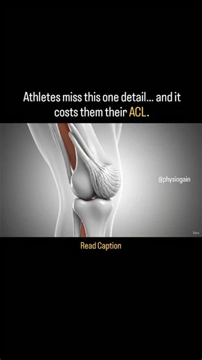 Physiogain on Instagram: "⚠️ Important Note The visuals may not be 100% anatomically perfect. This animation is created only to draw your attention and help visualize a concept that happens deep inside the knee. For correct medical understanding — always rely on professional guidance. ACL tears don’t happen in one big “snap.” They start with micro-fiber failures inside the ligament… Often long before the complete rupture. This video shows that process in slow motion. But read this carefully 👇 B