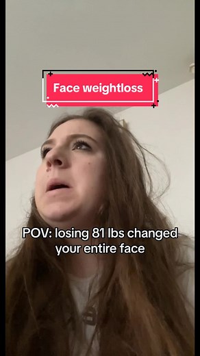 Transformation: Losing 81 lbs for a Stunning Face Glow-Up