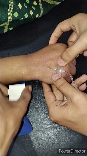 How to place a scalp vein set to give intravenous fluid | complete step by step procedure #procedure