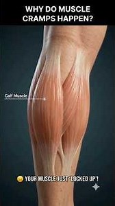 Why Do Muscle Cramps Happen? 😖 What’s Really Happening Inside Your Muscle