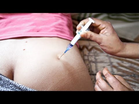 Title: Hip IM Injection Technique | Safe Buttocks Injection Step by Step | Nurse Training Guide
