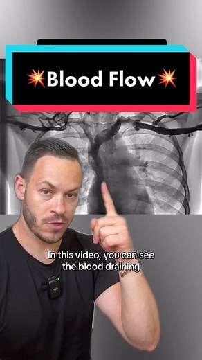 💥Blood Flow💥 . The fluid of life. . 👉🏼 Blood flow is managed by the circulatory system, which includes the heart, blood vessels, and blood. The heart pumps oxygenated blood to the body's tissues through arteries and receives deoxygenated blood back through veins. . 👉🏼 Blood carries essential nutrients and oxygen to cells throughout the body. Oxygen binds to hemoglobin in red blood cells, while nutrients are dissolved in plasma, the liquid portion of blood. . Capillaries, the tiniest blood 