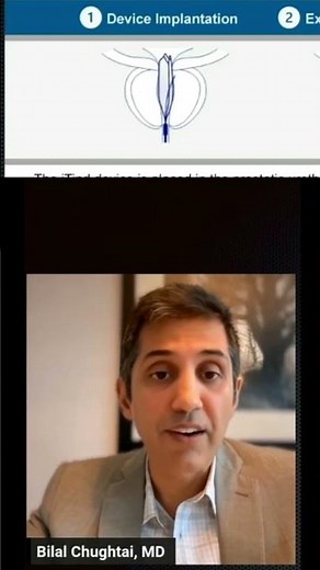 What is the iTind Procedure