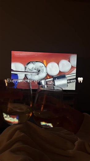 Our favorite show is @MDM Customs amalgam restoration! #dentalstudent #amalgam #class2 #dentistry