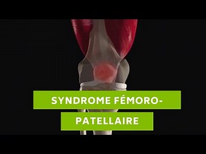 Le syndrome fémoro-patellaire, c'est quoi ? - Nxt Generation PHYSIO