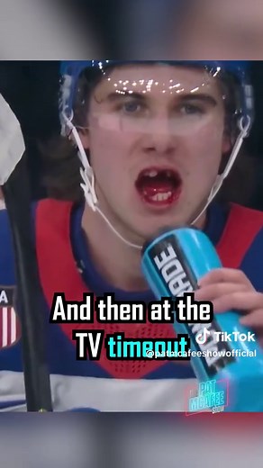 Jack Hughes: Chipped Tooth but Team Spirit Remains High