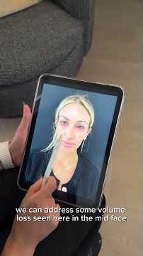 Skin care Assesment for Lasers Botox, Fillers at Skinsation LA