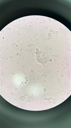 Microscope Examination: Insights and Discoveries