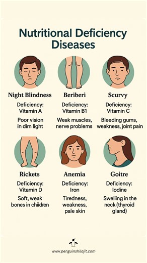 6 Deficiency Diseases You Should Never Ignore Learn the 6 most common nutritional deficiency diseases and the vitamins/minerals your body needs to prevent them. Night blindness, beriberi, scurvy, rickets, anemia, and goitre — all linked to simple nutrient gaps. Strengthen your diet, boost energy, and stay healthy naturally. | Penguin Wellness