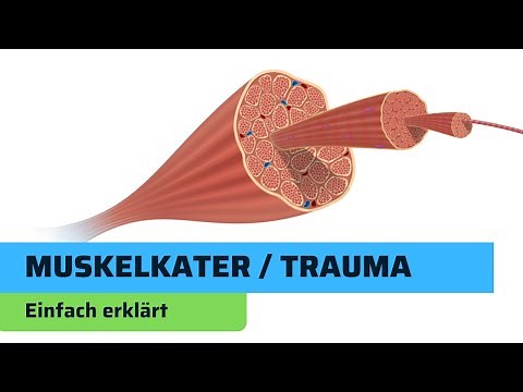 Muscle soreness simply explained - Fitness Basics