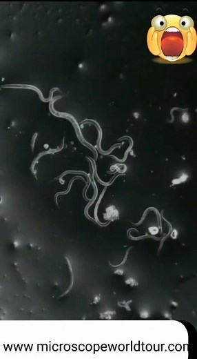 Microscopic View of Dirt Under Nails Revealed