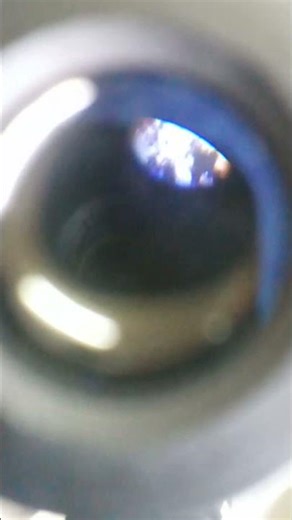 + gram staining in microscope slide 😱🫶🌸❣️