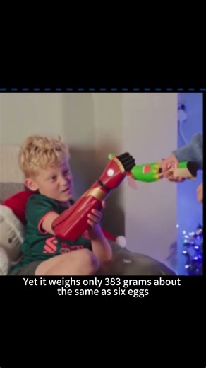 You Won’t Believe This Bionic Hand 🤯 | Not Sci-Fi, It’s Real!