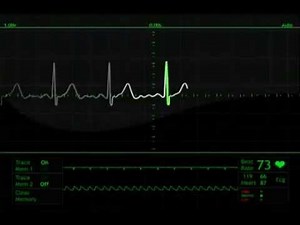 heart beat monitor animation free stock footage