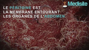 Les 3 signes d’alerte d’un cancer du péritoine https://goo.gl/tA7L2s | Medisite.fr