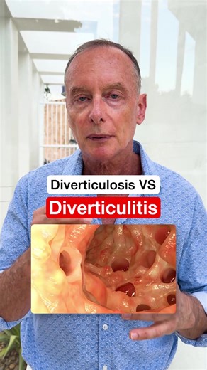 Understanding Diverticulosis and Diverticulitis