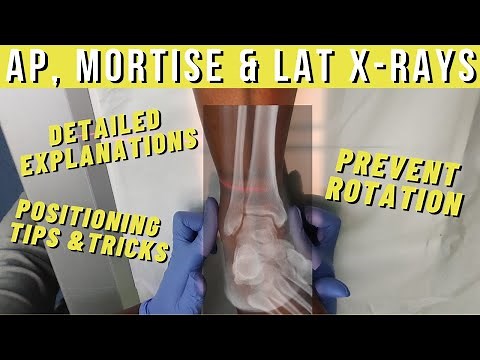 how to: AP, Mortise & Lateral Ankle X-rays || Ask The Rad Tech