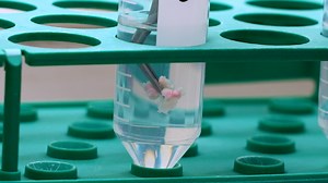 Isolation of Epithelial Cells from Human Dental Follicle