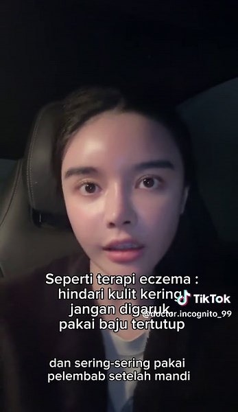 Nodul = jendol2. Agak berat nih tapi aku orangnya menepati janji 🙂 nih sekilas terapi darah manis/prurigo udah simplified, banyak yang ga ada di Indonesia. Suntik dupixent untuk prurigo nodularis (dewasa) sisanya boleh lah untuk sementara. Penting juga untuk telusuri sebabnya apa. Untuk bekasnya? Sama kayak terapi PIH ya #prurigonodularis #darahmanis #prurigo #terapigatal #sekilas #edukasi #skincare #terapi