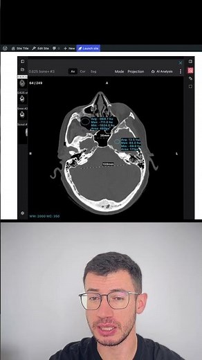 How to Embed Interactive DICOM Scans in Your Medical Blog (WordPress, Notion)