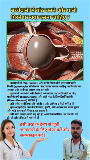 बच्चेदानी में गांठ बनने और पानी गिरने पर क्या करना चाहिए ? Fibroid Uterus problem in women #viral