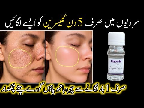 Apply Glycerin in winters in such a way that your Face hands and feet become milkywhite and softover