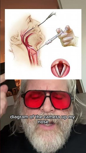 Vocal fold filler injection for the treatment of vocal atrophy. #singer
