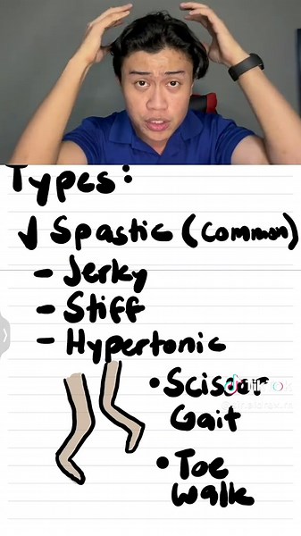 Cerebral Palsy Types Simplified. 🫶🏼 Hi, I am sir Aldrex, your topnotcher-lecturer! Let’s make Med-Surg concepts simple! Follow for more: @clydeus_ on Instagram #PNLE2025 #SirAldrexRN #FutureRNs #Review #NurseGoalsPH #fyp #fypシ゚ #nursingstudent #foryou #nle #rn #pnle #nursing #medsurg #review #lecture #nursingreview #medicine #NursingSchool #nursetok #RN2025 #RN #boardexam #cerebralpalsy #neuro #neurology #motor #movement #pedia #seizures #intellectualdisability