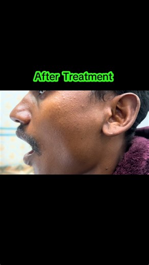 Jaw Popping and Locking Solutions for TMJ Issues