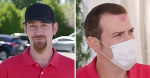 'Dr Pimple Popper': Corey bullied over 'horn' cyst on forehead, called 'devil worshipper'