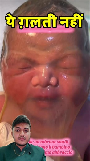 amniotic sac #amnioticfluid #amnioticsac #pregnancy