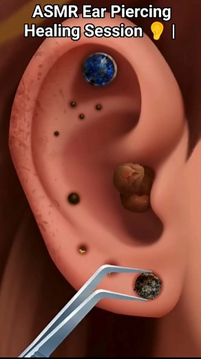 ASMR Ear Piercing Healing Session 👂 | Gentle Cleaning & Relief | #video #Animation #reels #trending #shorts | Akhilesh Yadav