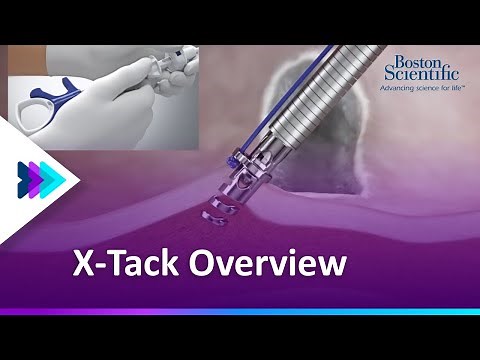 X-Tack™ Endoscopic Helix Tacking System Animation | Boston Scientific