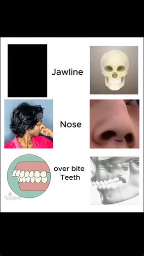 Ｓｈｙａｍ 🇮🇳 | 99% Log Inpe Yakeen Kar Lete Hai 😭 ⭐ 🔥 DESCRIPTION (Hindi + English Mix, Super SEO Optimized) Slow vs Fast Results – Jawline, Nose &... | Instagram