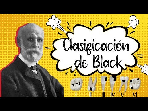 🦷Black Dentistry Classification: Easy and Well Explained! Definitive Guide
