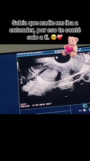 #mibebeyyo #madreehijos🥰 #fypシ゚ #fypシ゚viral🖤tiktok