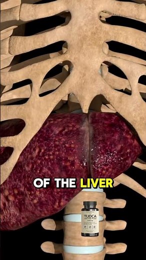 TUDCA Fatty Liver and Gallbladder Remedy | Revealed by Dr Berg