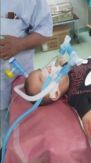 Child under General anesthesia : Undergoing Herniotomy #baby #doctorlife #medicalshorts #hospital