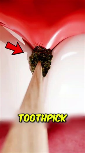 STOP Using Toothpicks… You’re Damaging Your Gums 😬