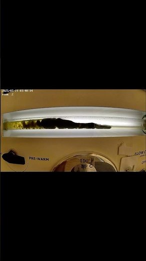 Pov: getting rid of mucoid plaque during a colonic irrigation #colonics #guthealth