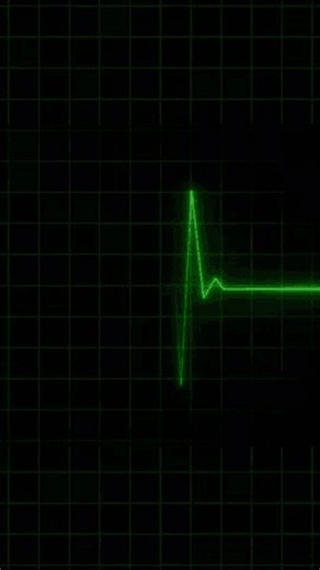 clip-3991116259-animation-endless-loop-ekg-heart-monitoring-display
