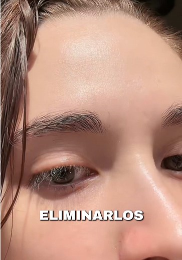¿Qué pasó con los granos que tenía hace una semana? ¿Funcionó mi rutina de Skincare para eliminar comedones? Los productos que usé son la crema 345 y el retinol de Dr Althea @dr.althea_es @Dr.Althea US 🤨❤️‍🩹 #SkinCare #rutinadeskincare #skincarecoreano #acne #comedones
