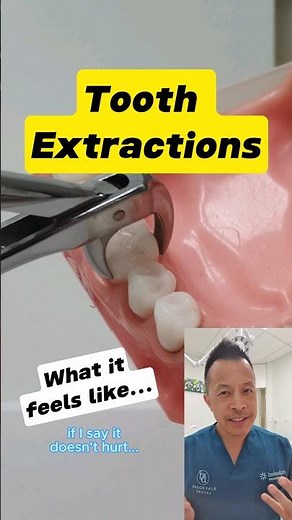 Preparing for Tooth Extraction: Does It Really Hurt? #shorts #dentallan #dentist