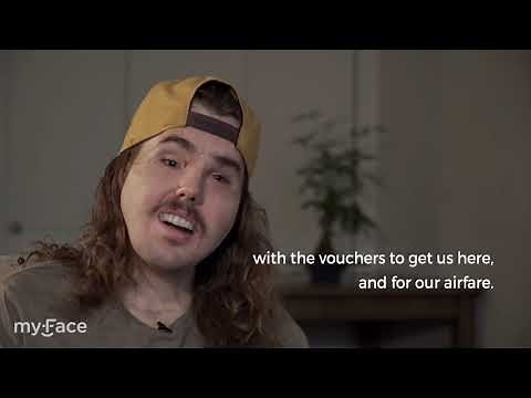 Cameron Underwood Interview - Face Tranplant Patient